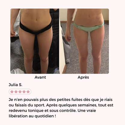 PelviForm - Intima Fit