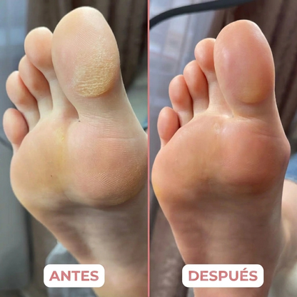 Pies suaves - Velse™